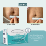 Oxyprolane® Repair – Régénération de la peau, vergetures