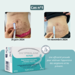 Oxyprolane® Repair – Régénération de la peau, vergetures